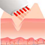caci wrinkle comb before