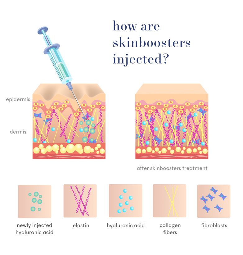 Skin Boosters
