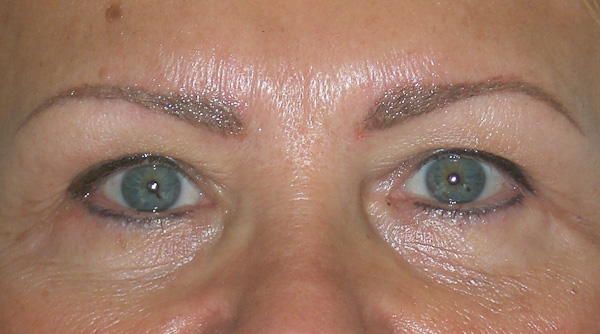 Permanent eye liner 3