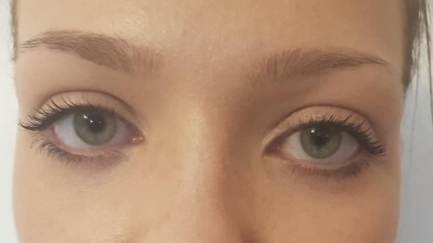 Client 1 brows before Client 1 brows before